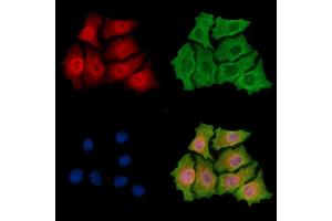 ABIN7095883 and ABIN7099945 staining HepG2 cells by IF/ICC. (PHRF1 antibody)