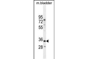 Western blot analysis in mouse bladder tissue lysates (35ug/lane). (C17orf59 antibody  (AA 186-215))