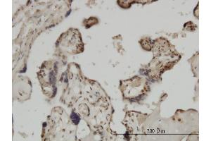Immunoperoxidase of monoclonal antibody to ZIC4 on formalin-fixed paraffin-embedded human placenta. (ZIC4 antibody  (AA 249-319))