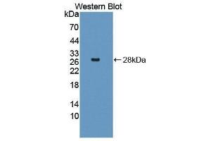 Western Blotting (WB) image for anti-Selectin E (SELE) (AA 23-240) antibody (ABIN1870715) (Selectin E/CD62e antibody  (AA 23-240))
