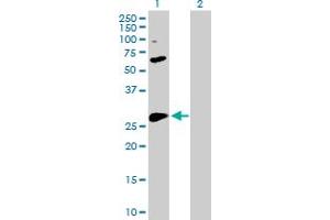 Western Blot analysis of BCL2L1 expression in transfected 293T cell line by BCL2L1 MaxPab polyclonal antibody. (BCL2L1 antibody  (AA 1-233))
