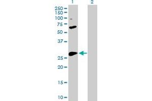 Western Blot analysis of BCL2L1 expression in transfected 293T cell line by BCL2L1 MaxPab polyclonal antibody.