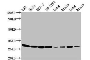 Western Blot Positive WB detected in: 293 whole cell lysate, Hela whole cell lysate, MCF-7 whole cell lysate, SH-SY5Y whole cell lysate, Rat lung tissue, Rat brain tissue, Mouse lung tissue, Mouse brain tissue All lanes: BCAP31 antibody at 4. (BCAP31 antibody  (AA 2-243))