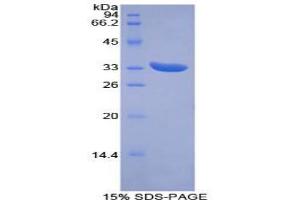SDS-PAGE analysis of Mouse PINK1 Protein. (PINK1 Protein)