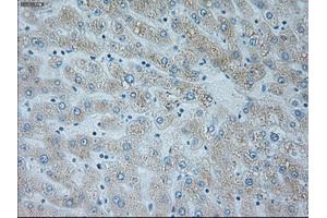 Immunohistochemical staining of paraffin-embedded lymph node tissue using anti-NEUROG1mouse monoclonal antibody. (Neurogenin 1 antibody)
