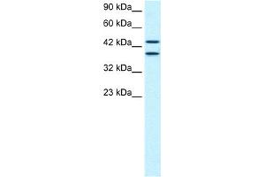 WB Suggested Anti-C14ORF131 Antibody Titration:  0. (ZNF839 antibody  (Middle Region))