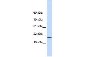 CENPA antibody used at 1 ug/ml to detect target protein. (CENPA antibody  (Middle Region))