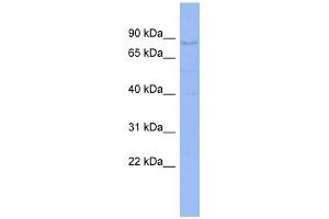 WB Suggested Anti-CNOT3 Antibody Titration:  0. (CNOT3 antibody  (C-Term))