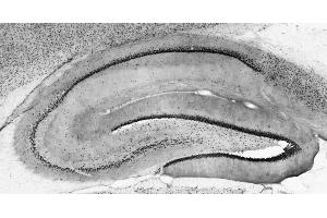 Adult rat hippocampus immunohistochemistry.