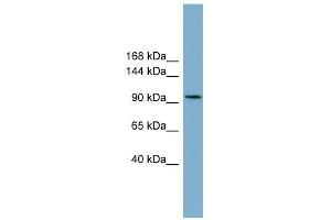SLC12A3 antibody used at 1 ug/ml to detect target protein. (SLC12A3 antibody)