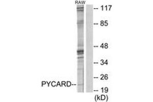 Western blot analysis of extracts from RAW264. (STS antibody  (AA 10-59))