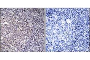 Immunohistochemistry analysis of paraffin-embedded human tonsil tissue, using BCAS4 Antibody. (BCAS4 antibody  (AA 31-80))