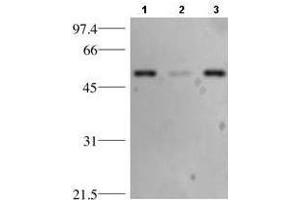 Western blotting using anti-p53. (p53 antibody)