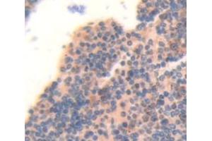 Figure. (MYL12B antibody  (AA 5-172))