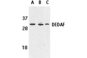 Western blot analysis of DEDAF expression in human A549 (lane A), HepG2 (lane B), and mouse 3T3 (lane C) cell lysates with AP30284PU-N DEDAF antibody at 1 μg /ml.
