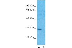 Western Blotting (WB) image for anti-Four and A Half LIM Domains 1 (FHL1) (C-Term) antibody (ABIN2775759)