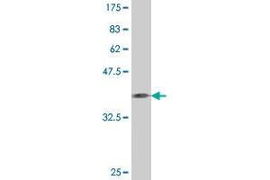 Western Blot detection against Immunogen (37. (CD93 antibody  (AA 33-140))