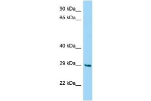 WB Suggested Anti-Fam122b Antibody Titration: 1. (FAM122B antibody  (N-Term))
