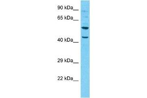 Western Blotting (WB) image for anti-Nuclear Receptor Subfamily 2, Group F, Member 2 (NR2F2) (N-Term) antibody (ABIN2792599)