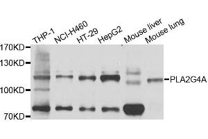 Western blot analysis of extracts of various cells, using PLA2G4A antibody. (PLA2G4A antibody)