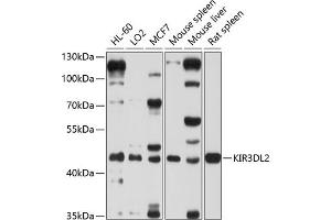 Western blot analysis of extracts of various cell lines, using KIR3DL2 antibody (ABIN6131968, ABIN6142888, ABIN6142889 and ABIN6214251) at 1:1000 dilution. (KIR3DL2 antibody  (AA 361-455))