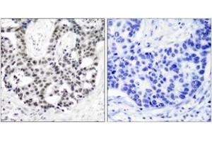Immunohistochemistry (IHC) image for anti-Androgen Receptor (AR) (pSer650) antibody (ABIN2888357) (Androgen Receptor antibody  (pSer650))