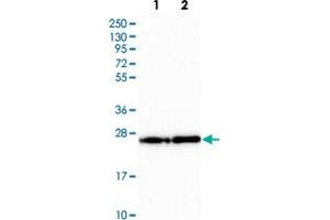Western blot analysis of Lane 1: Human cell line RT-4 Lane 2: Human cell line U-251MG with PDAP1 polyclonal antibody  at 1:250-1:500 dilution.