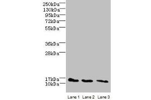 Western blot All lanes: C2orf15 antibody at 6 μg/mL Lane 1: U251 whole cell lysate Lane 2: MCF-7 whole cell lysate Lane 3: HCT116 whole cell lysate Secondary Goat polyclonal to rabbit IgG at 1/10000 dilution Predicted band size: 14 kDa Observed band size: 14 kDa (C2ORF15 antibody  (AA 1-125))