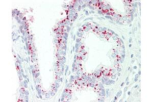 Anti-GAA antibody IHC staining of human prostate.