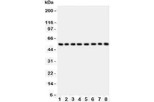 Western blot testing of P2X2 antibody and Lane 1:  rat brain;  2: mouse brain;  3: human placenta;  4: (h) HeLa;  5: (h) SHG-44;  6: (m) Neuro-2a;  7: (h) 22RV1;  8: (h) U87 lysate. (P2RX2 antibody  (AA 139-471))