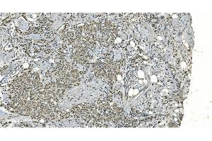 IHC analysis of LSM8 using anti-LSM8 antibody (ABIN7599579).