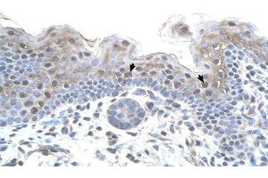 STRAP antibody was used for immunohistochemistry at a concentration of 4-8 ug/ml to stain Squamous epithelial cells (arrows) in Human Skin. (STRAP antibody  (N-Term))