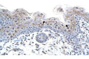 STRAP antibody was used for immunohistochemistry at a concentration of 4-8 ug/ml to stain Squamous epithelial cells (arrows) in Human Skin. (STRAP antibody  (N-Term))