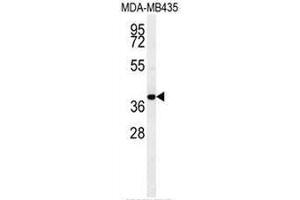CCR8 Antibody (C-term) western blot analysis in MDA-MB435 cell line lysates (35µg/lane). (CCR8 antibody  (C-Term))