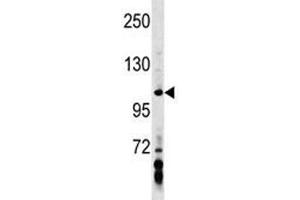 AXIN1 antibody western blot analysis in MDA-MB453 lysate. (Axin antibody  (AA 330-359))