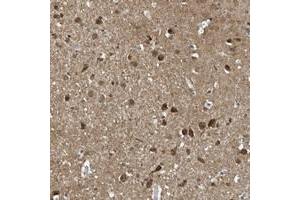 Immunohistochemical staining of human cerebral cortex with NCOA7 polyclonal antibody  shows strong nuclear and cytoplasmic positivity in neuronal cells at 1:50-1:200 dilution. (NCOA7 antibody)