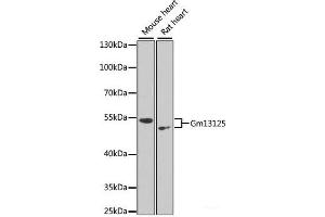 Western blot analysis of extracts of various cell lines using Gm13125 Polyclonal Antibody at dilution of 1:1000.