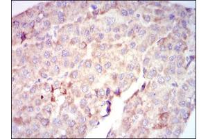 Image no. 2 for anti-V-Raf-1 Murine Leukemia Viral Oncogene Homolog 1 (RAF1) antibody (ABIN1500583) (RAF1 antibody)