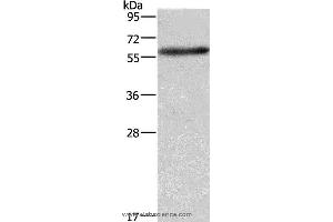 Western blot analysis of A172 cell, using AMIGO2 Polyclonal Antibody at dilution of 1:597 (AMIGO2 antibody)
