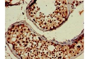 Immunohistochemistry of paraffin-embedded human testis tissue using ABIN7174583 at dilution of 1:100 (USP18 antibody  (C-Term))