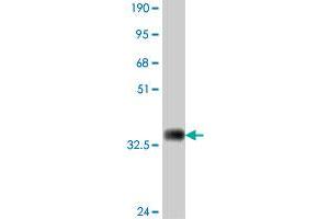 Western Blot detection against Immunogen (35. (LRP8 antibody  (AA 83-170))