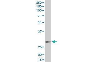 SNAP29 MaxPab rabbit polyclonal antibody. (SNAP29 antibody  (AA 1-258))
