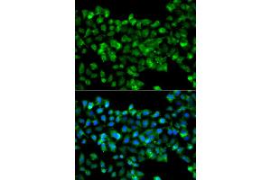 Immunofluorescence analysis of A549 cells using CBR3 antibody (ABIN5975603). (CBR3 antibody)