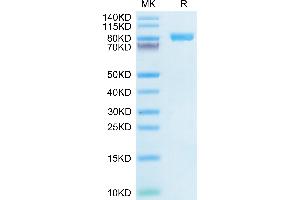 Interleukin 6 Receptor, alpha (IL6RA) (AA 20-365) protein (Fc Tag)