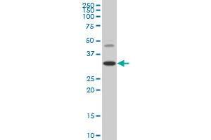 HOXD8 monoclonal antibody (M02), clone 3G8 Western Blot analysis of HOXD8 expression in HepG2 . (HOXD8 antibody  (AA 126-190))