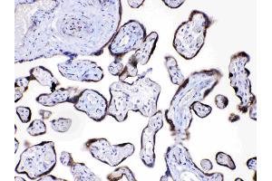 Angiopoietin-2 was detected in paraffin-embedded sections of human placenta tissues using rabbit anti- Angiopoietin-2 Antigen Affinity purified polyclonal antibody (Catalog # ) at 1 µg/mL. (Angiopoietin 2 antibody  (AA 180-283))