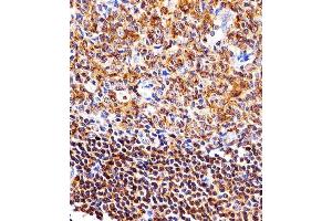 Paraformaldehyde-fixed, paraffin embedded Human tonsil tissue, Antigen retrieval by boiling in sodium citrate buffer (pH6. (NFKB1 antibody)