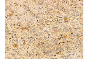 ABIN6256878 and ABIN6274572 at 1/100 staining Mouse brain tissue by IHC-P.
