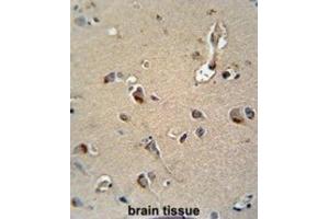 Immunohistochemistry (IHC) image for anti-Myelin Protein Zero (MPZ) antibody (ABIN3003838) (MPZ antibody)