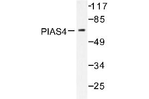 Image no. 2 for anti-Protein Inhibitor of Activated STAT, 4 (PIAS4) antibody (ABIN271954) (PIAS4 antibody)